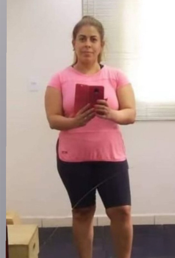 Antes - Transformação 2